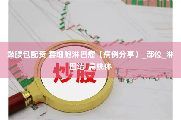 鼓腰包配资 套细胞淋巴瘤（病例分享）_部位_淋巴结_扁桃体